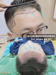 -熙朵美学植发·连锁品牌