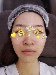 体验后-深圳美莱医疗美容医院