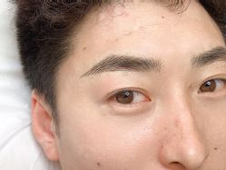 -德绣·机器野生眉发际线·美瞳线半永久