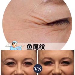 -兰派国际美容养生SPA