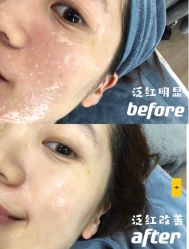 -慕颜医疗美容·皮肤微整 抗衰
