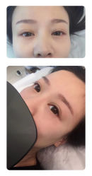 -MIVI半永久纹眉绣眉
