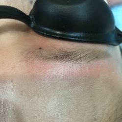 -郡艺医疗美容·微整·眼鼻吸脂