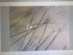 -碧莲盛·不剃发植发