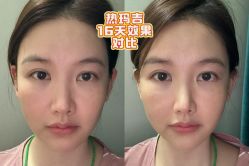 -上海伊莱美医疗美容医院