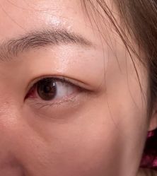 -美莱医疗美容医院