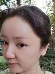 -北京雍禾植发医院