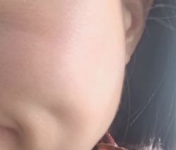 -铂特丽医美·眼鼻整形·光电美肤·注射抗衰
