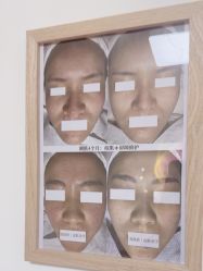 -美肤盾祛痘·问题肌头疗管理中心