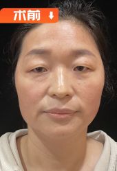 -素美医疗美容·西南眼鼻整形·修复基地