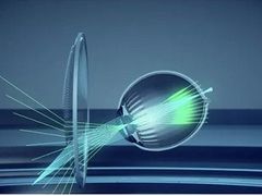 -宝岛眼镜(苏州浒关店)