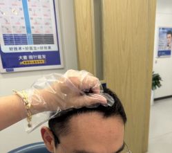 点击看大图 -大麦微针植发全国连锁