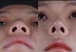 -北京米扬丽格医疗美容·联合丽格鼻整形中心