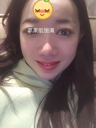 体验后-JS医疗美容