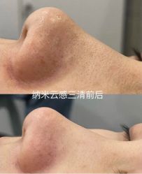 -SKIN79皮肤管理中心