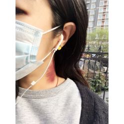 -安那般那皮肤年轻化ANAPANA