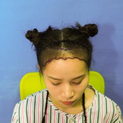 -碧莲盛·不剃发植发