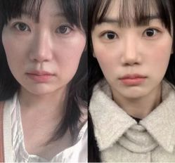 -杭州米兰柏羽医疗美容医院