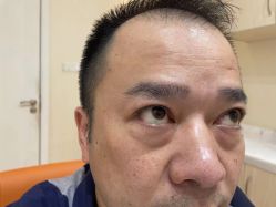 点击看大图 体验前-广州健丽·去眼袋医疗美容机构