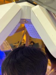 -碧莲盛·不剃发植发