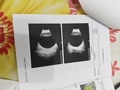 -上海市眼病防治中心(康定路院区)