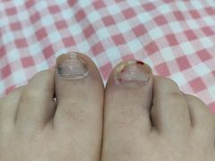 -新甲连锁灰指甲·甲沟炎·鸡眼(黑龙江路店)