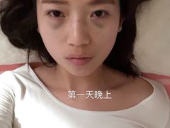 体验后-上海华安整形外科门诊部
