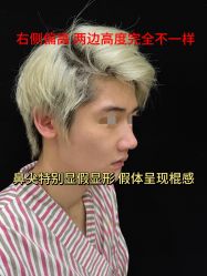 -北京米扬丽格医疗美容·联合丽格鼻整形中心