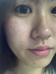 -西安伊美尔医疗美容医院