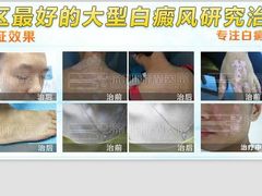 -世界之窗阿尔卑斯冰雪世界