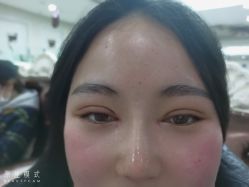 -西安壹加壹医疗美容·西北抗衰旗舰店