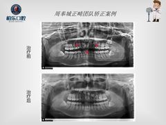 -柏乐口腔(南宁总院)