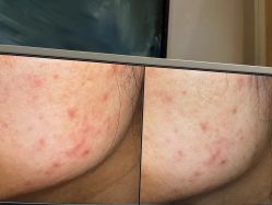 -苑苑vbeauty科技美容SPA