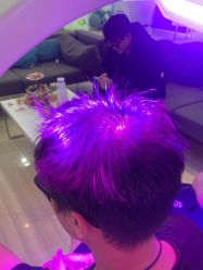 体验后-雍禾植发全国连锁