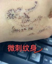 -微刺纹身