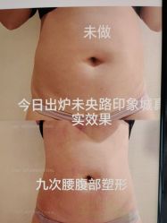-瘦立方身材管理中心