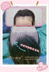 -熙朵美学植发·连锁品牌