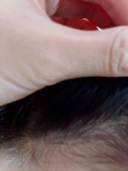 -熙朵美学植发·连锁品牌