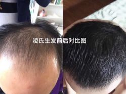 -凌氏生发养发馆