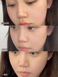 -上海漾颜医疗美容