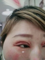 体验后-西安壹加壹医疗美容·西北抗衰旗舰店