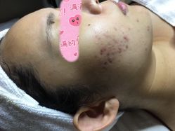 -皇族养心堂·净痘·修敏·御颜