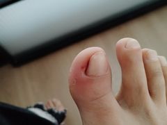 -郑远元专业修脚房(岭兜二路店)