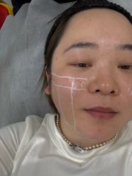 点击看大图 -Yestar艺星整形美容医院