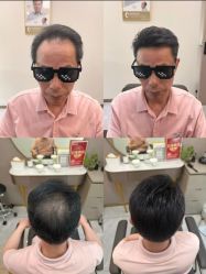 -唐风采假发补发定制