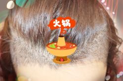 -大麦微针植发全国连锁