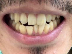 -佛山中大口腔医院·市二级口腔专科医院