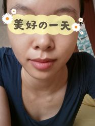 -天津健丽·去眼袋医疗美容机构