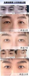 -丰联丽格医疗美容·联合丽格眼整形中心