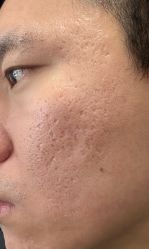 -杭州医巢医疗美容